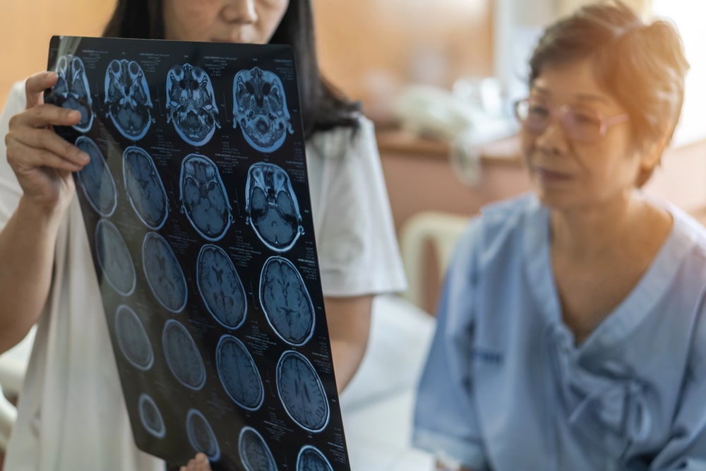 Brain Injury Claims: What You Need To Know
