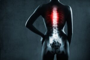 Spinal Cord Injuries After Truck Accidents