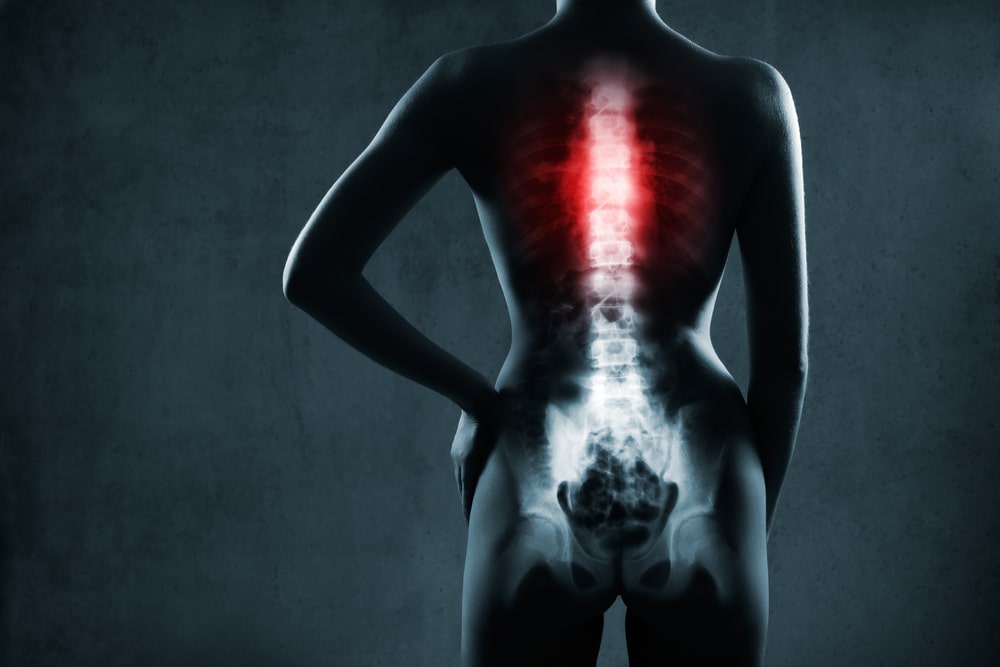 Spinal Cord Injuries After Truck Accidents