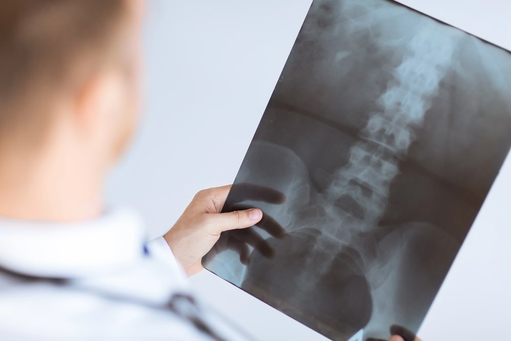 When Spine Pain Shows Up Days After a Crash